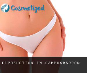 Liposuction in Cambusbarron