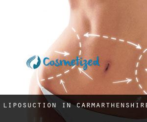 Liposuction in Carmarthenshire