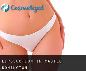 Liposuction in Castle Donington