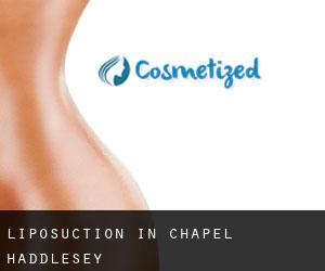 Liposuction in Chapel Haddlesey
