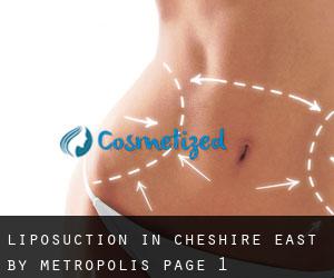 Liposuction in Cheshire East by metropolis - page 1