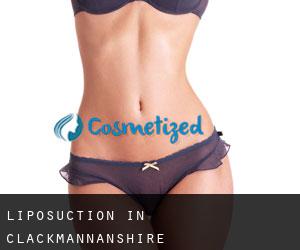 Liposuction in Clackmannanshire