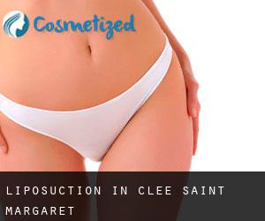 Liposuction in Clee Saint Margaret