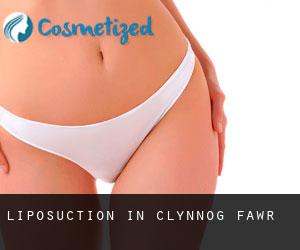 Liposuction in Clynnog-fawr