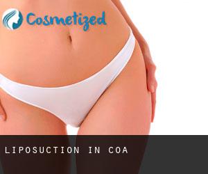 Liposuction in Coa