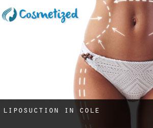 Liposuction in Cole