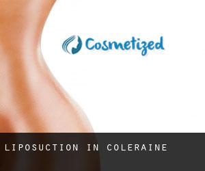 Liposuction in Coleraine