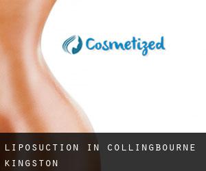 Liposuction in Collingbourne Kingston