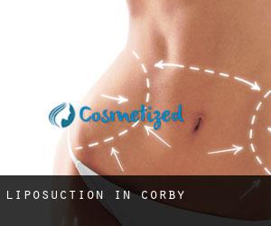 Liposuction in Corby
