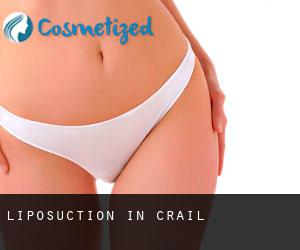 Liposuction in Crail