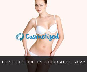 Liposuction in Cresswell Quay