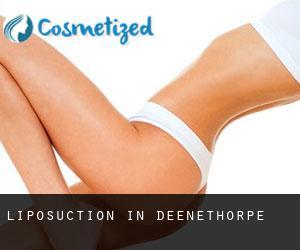 Liposuction in Deenethorpe