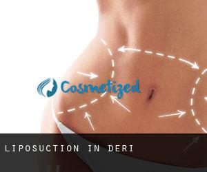 Liposuction in Deri