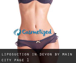 Liposuction in Devon by main city - page 1