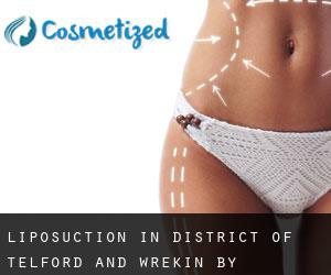 Liposuction in District of Telford and Wrekin by metropolitan area - page 1