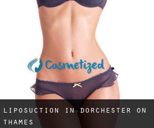 Liposuction in Dorchester on Thames