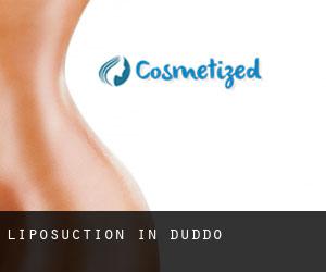 Liposuction in Duddo