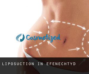Liposuction in Efenechtyd