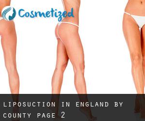 Liposuction in England by County - page 2