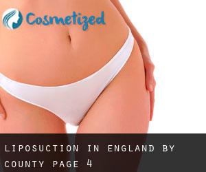 Liposuction in England by County - page 4