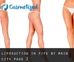 Liposuction in Fife by main city - page 2