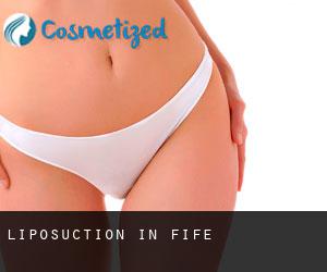 Liposuction in Fife