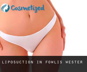 Liposuction in Fowlis Wester