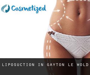 Liposuction in Gayton le Wold