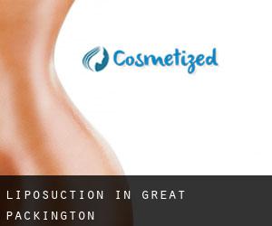 Liposuction in Great Packington