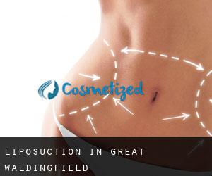 Liposuction in Great Waldingfield