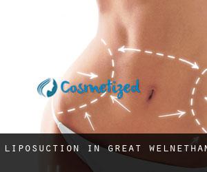 Liposuction in Great Welnetham