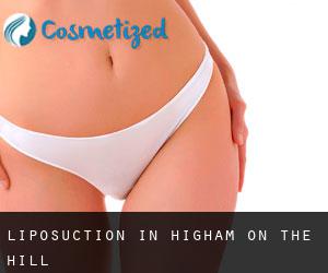 Liposuction in Higham on the Hill