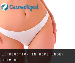 Liposuction in Hope under Dinmore