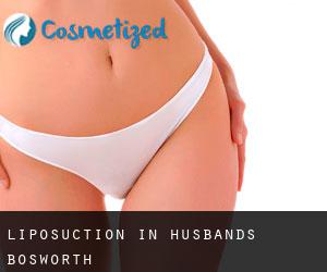 Liposuction in Husbands Bosworth