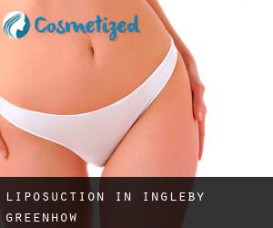 Liposuction in Ingleby Greenhow