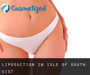 Liposuction in Isle of South Uist