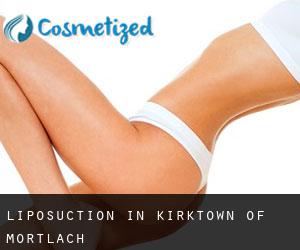 Liposuction in Kirktown of Mortlach