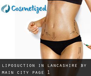Liposuction in Lancashire by main city - page 1