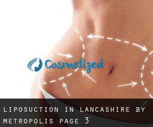 Liposuction in Lancashire by metropolis - page 3