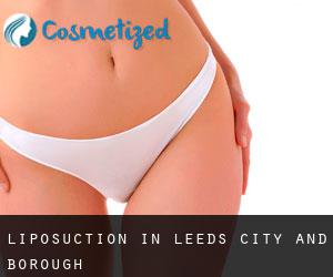 Liposuction in Leeds (City and Borough)