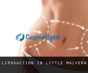 Liposuction in Little Malvern