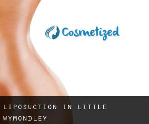 Liposuction in Little Wymondley