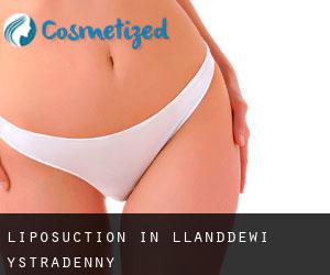 Liposuction in Llanddewi Ystradenny