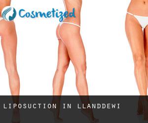 Liposuction in Llanddewi