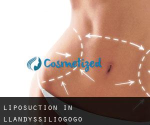 Liposuction in Llandyssiliogogo