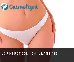 Liposuction in Llangybi