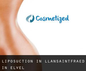 Liposuction in Llansaintfraed in Elvel
