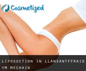 Liposuction in Llansantffraid-ym-Mechain