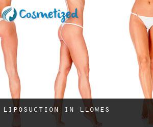 Liposuction in Llowes
