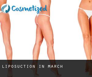 Liposuction in March